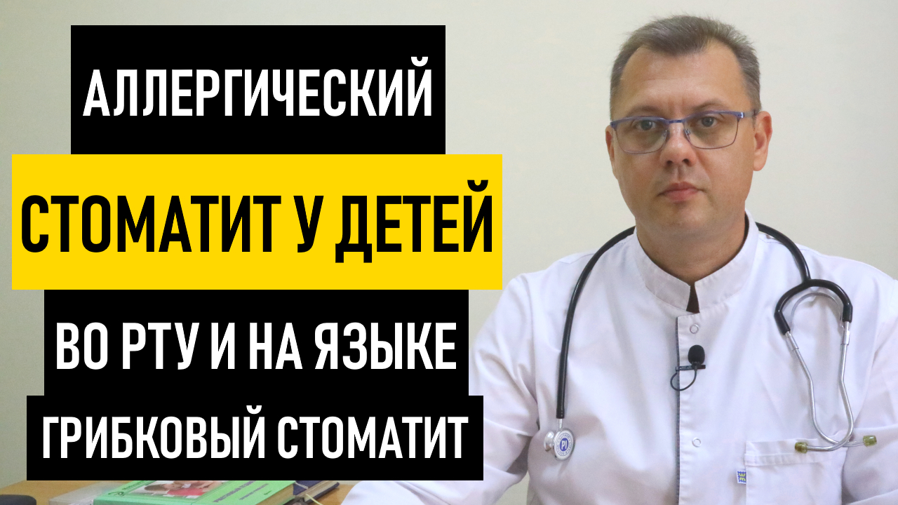 Аллергический Стоматит у Детей. Грибковый стоматит на языке у ребенка и новорожденных смотреть онлайн