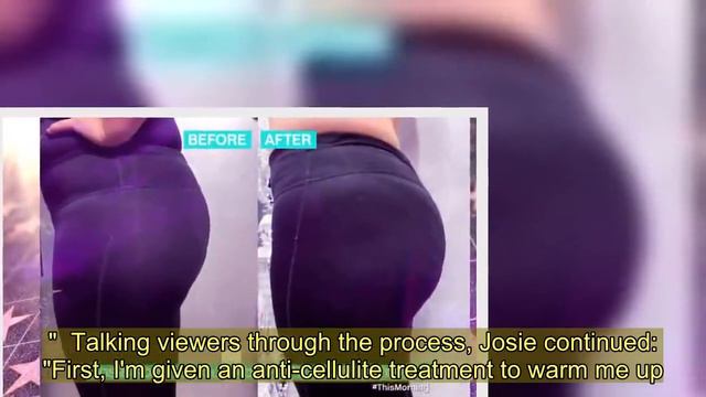 Josie Gibson shows off her newly plumped butt as she undergoes bum lift on This Morning смотреть онлайн