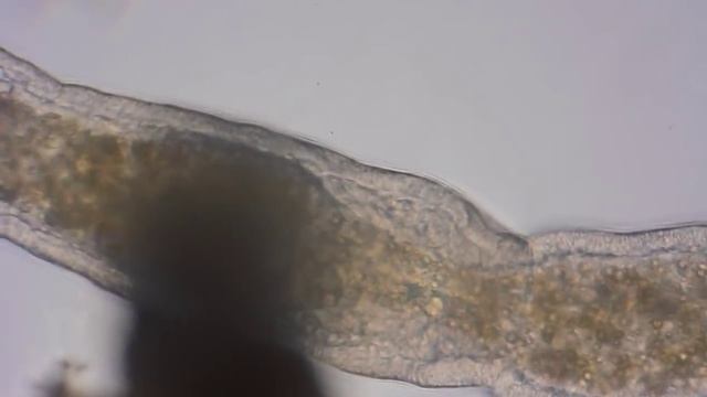 Flatworm Плоский Червь Stenostomum смотреть онлайн