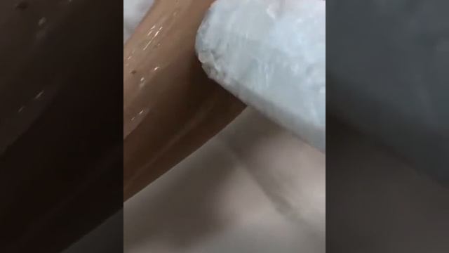 Лазерная эпиляция Элос ?