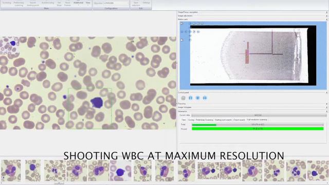 The MECO-HEMO automated scanner-analyzer for blood smear analysis смотреть онлайн