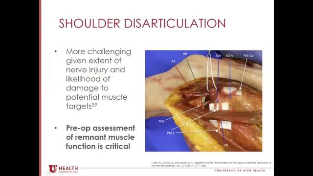 Targeted Muscle Reinnervation. Miranda Rogers, MD смотреть онлайн