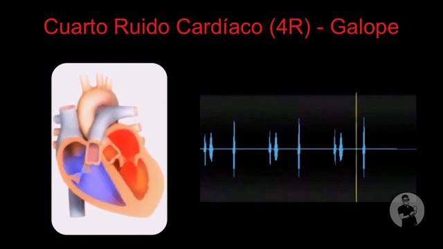 Ruidos y Soplos Cardíacos 🩺 🔊 | Semiología CardÍaca смотреть онлайн