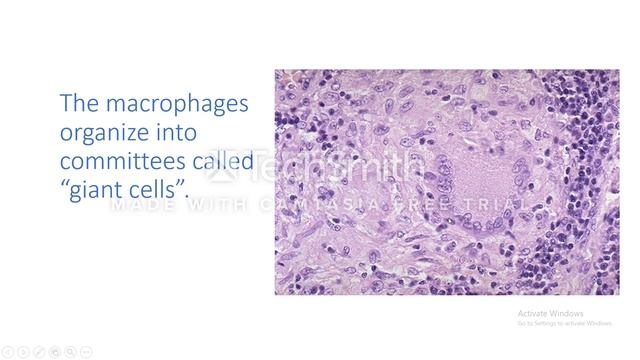 Primary Pulmonary Tuberculosis смотреть онлайн