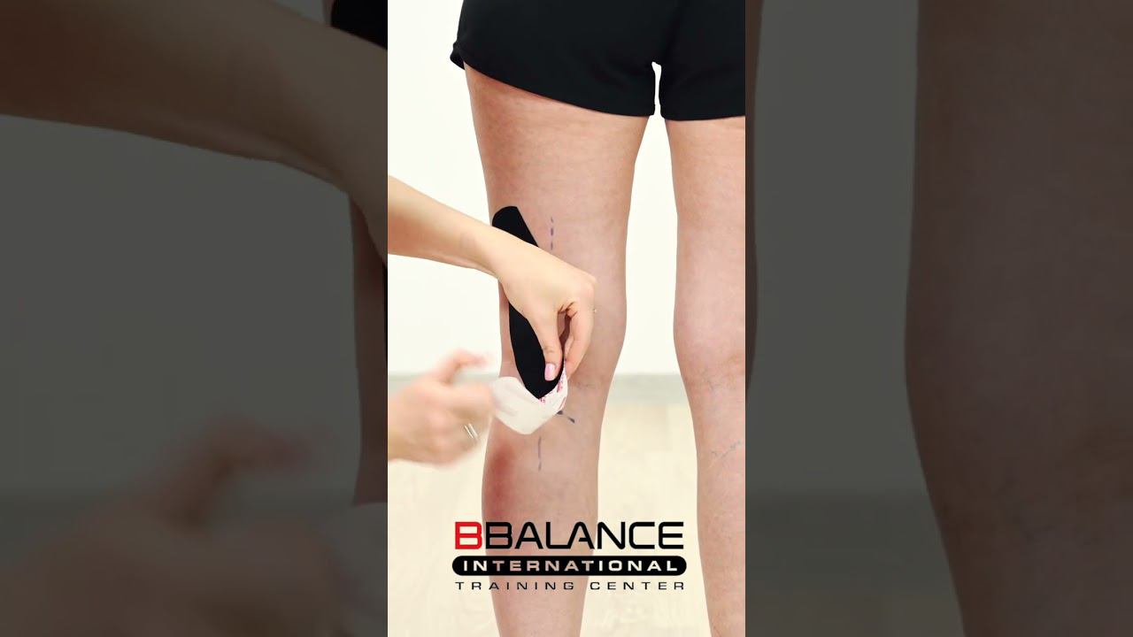 Тейпирование задней крестообразной связки смотреть онлайн