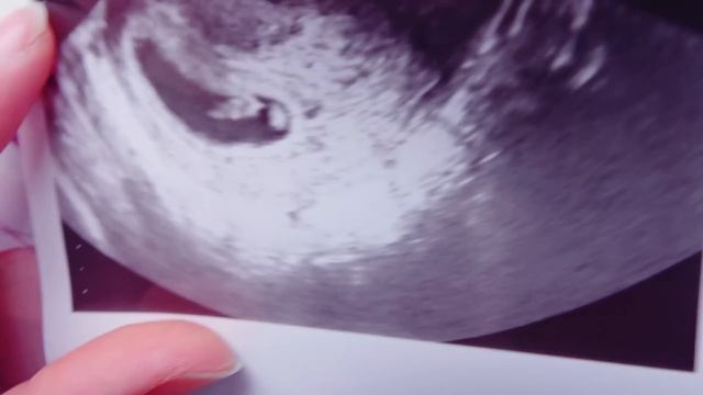 BLIŹNIAKI CZY TROJACZKI? Pierwsze USG w 4 Ciąży - Yoto MAMA Vlog смотреть онлайн