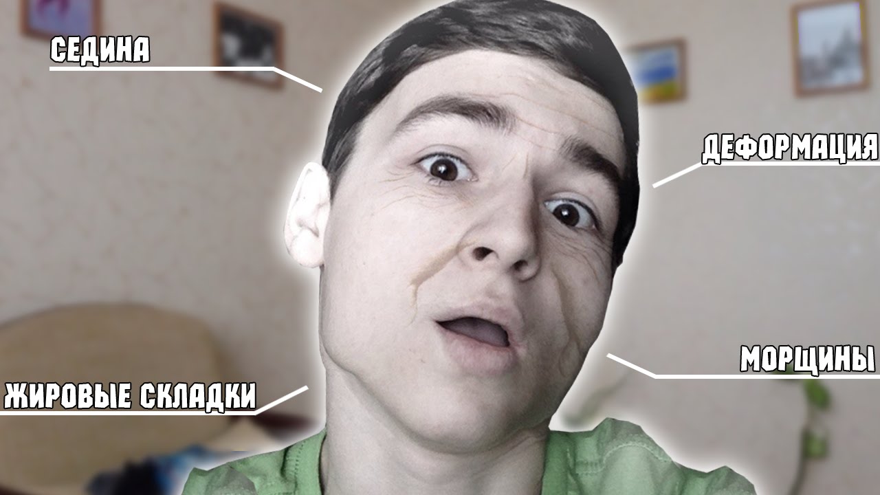 СТАРОСТЬ НЕ РАДОСТЬ смотреть онлайн