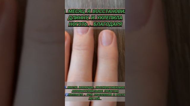 ОНИХОЛИЗИС #грибокногтей #сз #коллаген #ОНИХОЛИЗИС