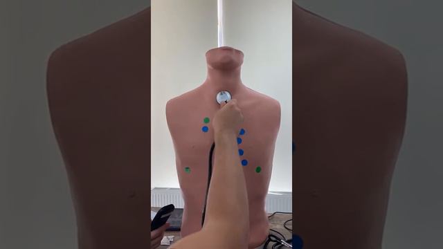 5 мелкопузырчатые влажные хрипы смотреть онлайн