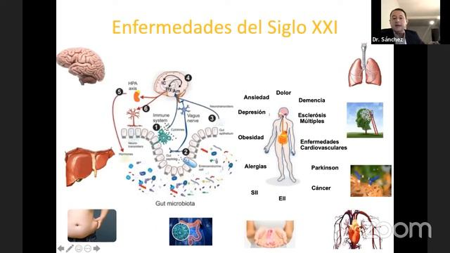 Intestino - Nuestro segundo Cerebro | Dr. Juan Carlos Sánchez Robles | Chat Médico смотреть онлайн