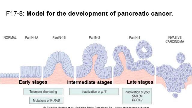 21th Lecture Video GIT = 2 Pancreas Path Wiswasi смотреть онлайн