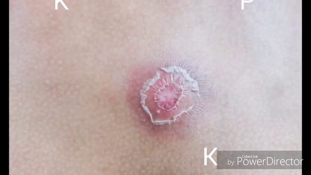 100% ЖУЗУНУЗДУ ТАЗАЛАЙТ!!! ЖУЗУНУЗДУН ТЕЗ УБАКЫТТА АГАРЫШЫН КААЛАЙСЫЗБЫ смотреть онлайн