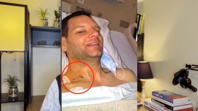 I Had An Ablation To Treat AFIB - 6 Things You Must Know