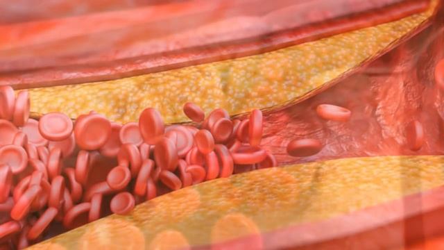 НЕ ЕШЬТЕ эти продукты от них мы СТАРЕЕМ быстрее. смотреть онлайн