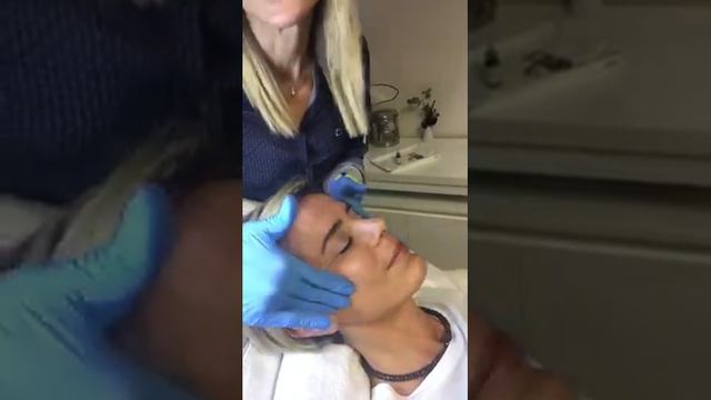 Akıllı Peeling-PQ Age смотреть онлайн