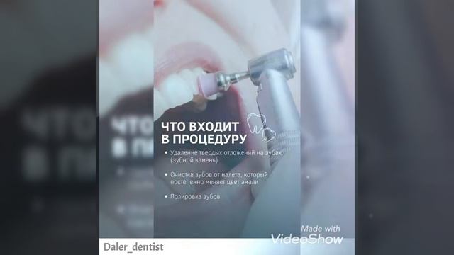 Почему стоит сделать профессиональную чистку зубов