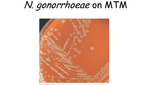 Part 3 Neisseria Moraxella 1 смотреть онлайн