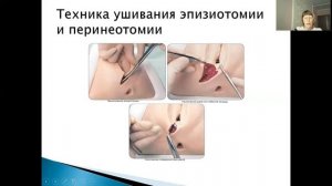 Видеолекция. Операции, проводимые в родах.mp4