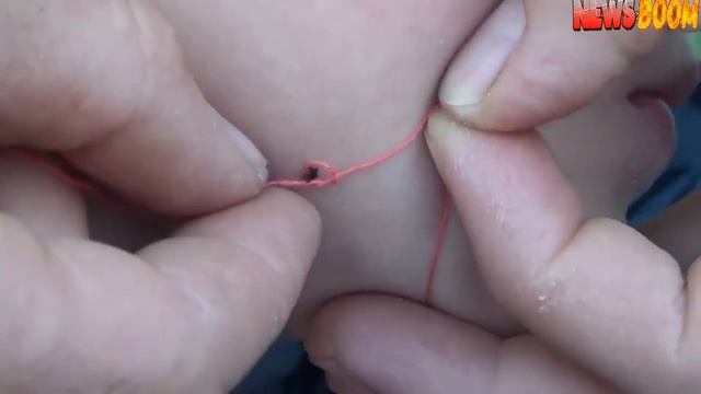 КАК ВЫТАЩИТЬ КЛЕЩА. СИМПТОМЫ ЭНЦЕФАЛИТА