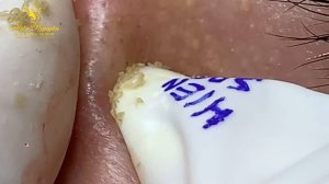 Satisfying Hien Spa Beauty Relaxing Video #11