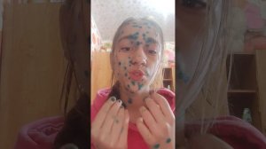 Все о ветрянки.Меры профилактики.Почему нужно переболеть в детстве?