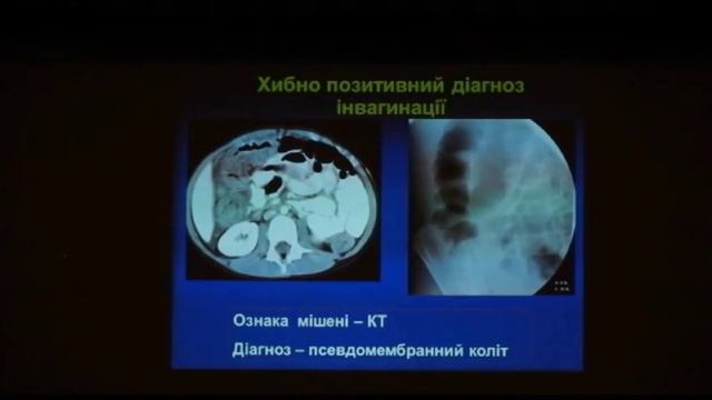 Обстеження при невідкладних станах у дітей смотреть онлайн