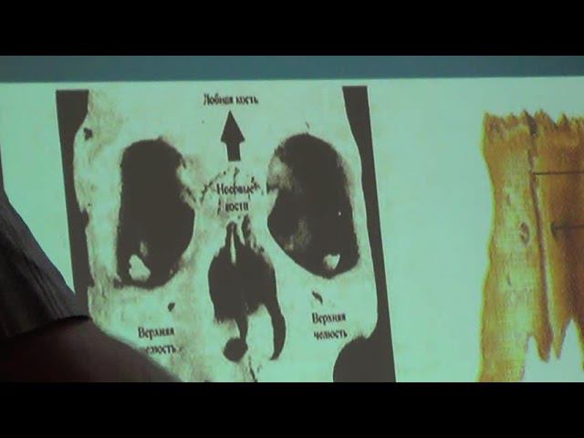 Семинар Краниосакральная терапия 2 КСТ2_028 смотреть онлайн
