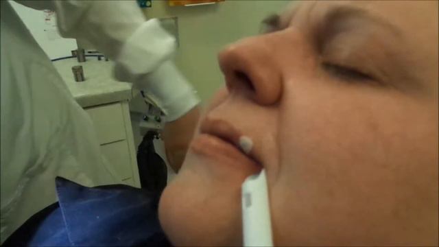 Laser Cold Sore смотреть онлайн