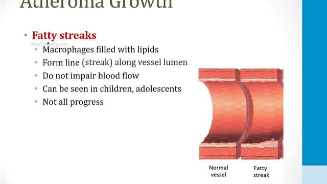 Cardiology - 2. Cardiac Ischemia - 1.Atherosclerosis atf смотреть онлайн