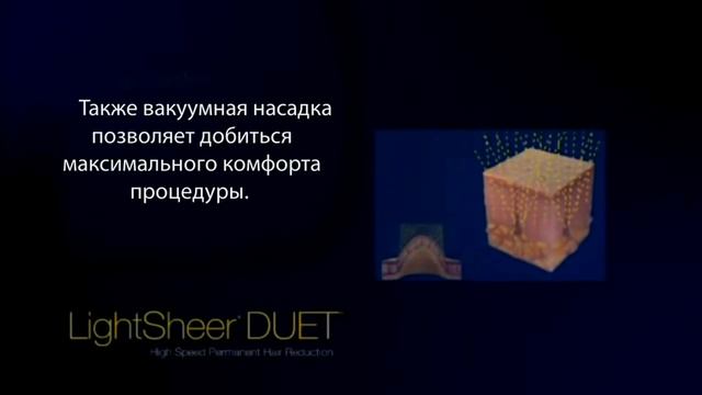 Lumenis Light Sheer Duet в Центрах Лазерхауз! смотреть онлайн