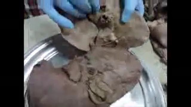 Module 17 - GIT - Practical Anatomy - dr Hazem Gamal - Soft Tissue - Version 3 смотреть онлайн