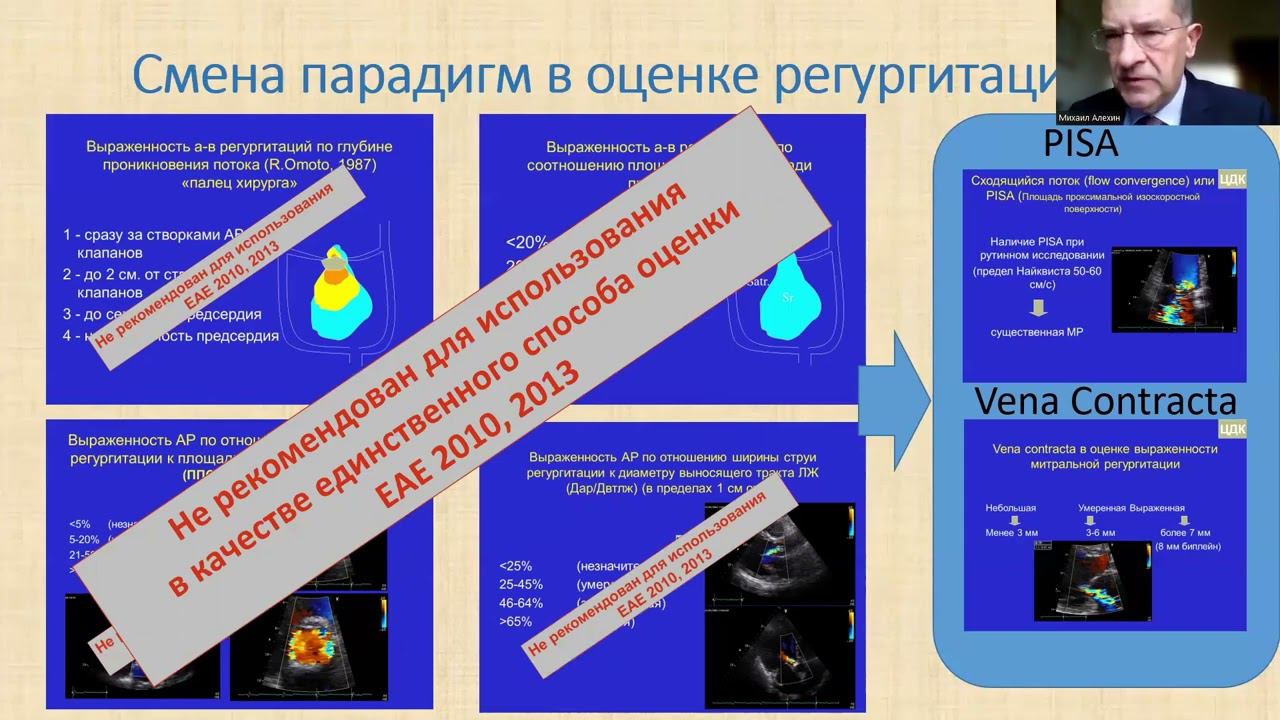 22.10 Научный симпозиум «Что нового в эхокардиографии- 2022» смотреть онлайн
