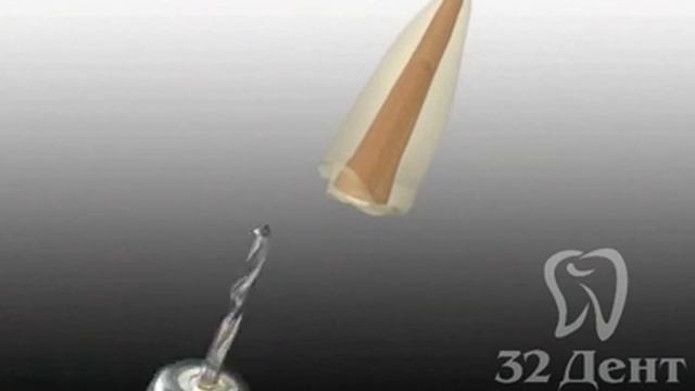 Эстетическая стоматология: восстановление зуба штифтом и коронкой смотреть онлайн