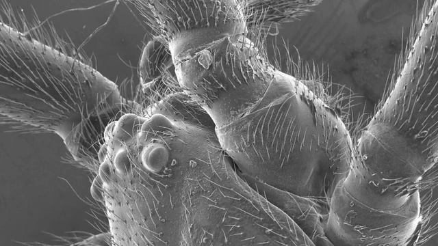 МИКРОБЫ ПОД МИКРОСКОПОМ.