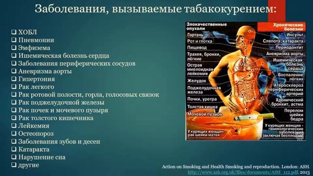 Мед профилактика. Лекция 2. Профилактика табакокурения смотреть онлайн