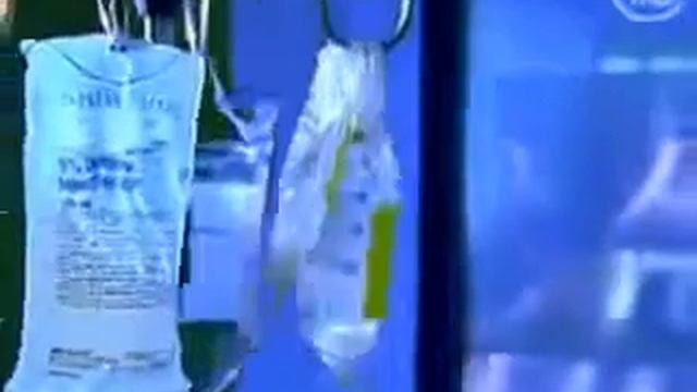 Работа и зашлакованность кишечника смотреть онлайн
