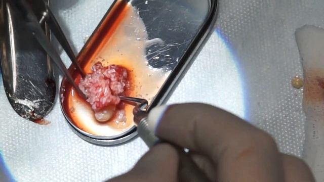 НКР. Sticky Bone. смотреть онлайн