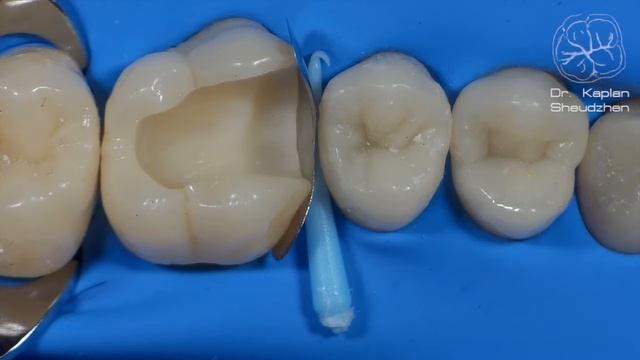 DentalПлюшки 11- адаптация матрицы смотреть онлайн
