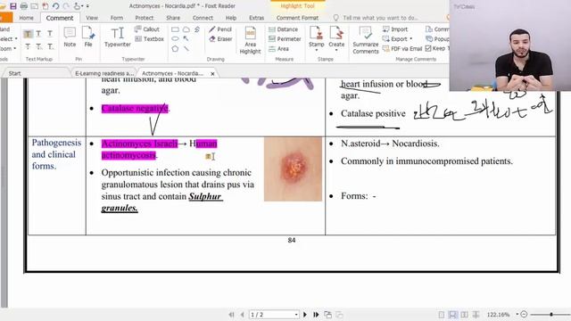 26-Actinomyces   Nocardia (نهاية منهج البكتريولوجى)