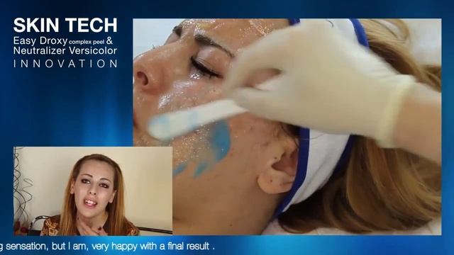 Easy Droxy peel at ESTERA.rs смотреть онлайн