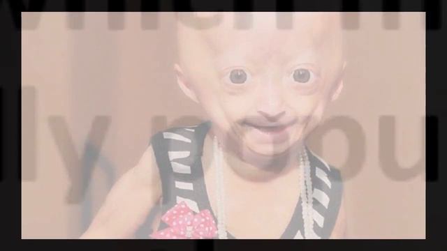 Progeria documentary - kaylee halko, Adalia rose, Sam berns, Hayley okines смотреть онлайн