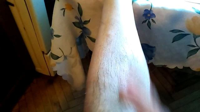 Мазь из каштанов при варикозе своими руками смотреть онлайн