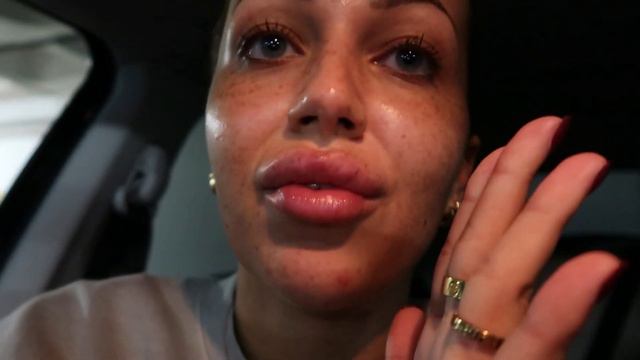 I GOT MY LIP FILLER COMPLETELY DISSOLVED! Asher Mary-Lou смотреть онлайн