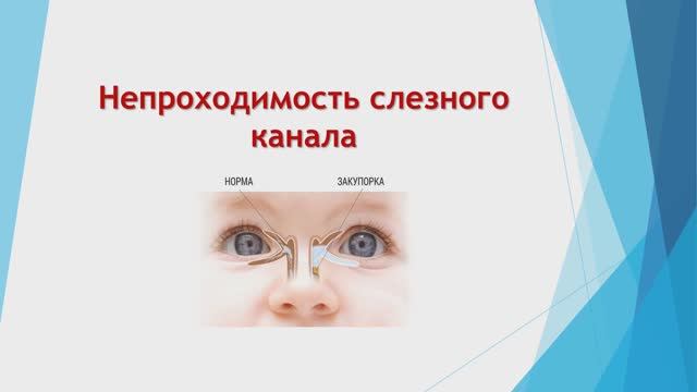 Непроходимость слезного канала смотреть онлайн