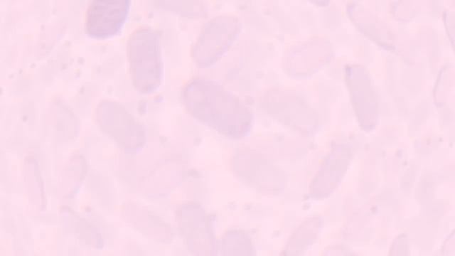 Bacteriophage Vs Ecoli Animation