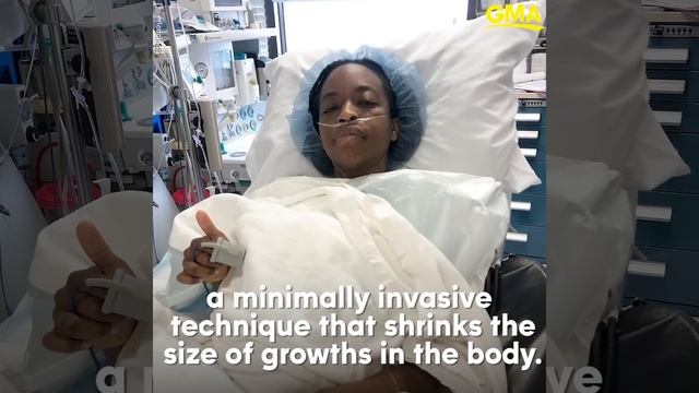 Woman who had uterine fibroids removed urges others to self-advocate at the doctor | GMA смотреть онлайн