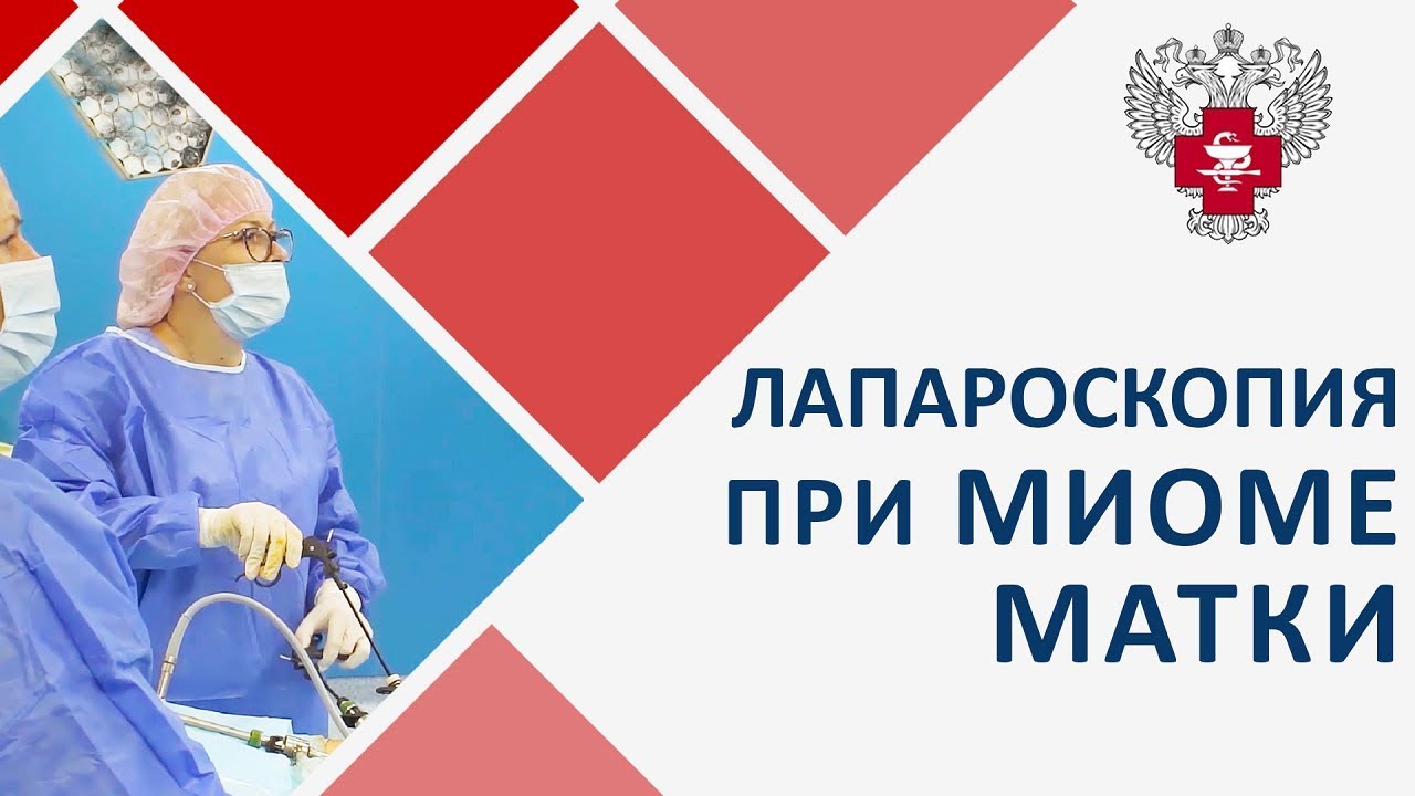 ? Щадящие методы лечения миомы матки. Миома матки лечение. Пироговский Центр. 12+ смотреть онлайн