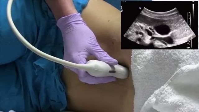 How I do it: Ultrasound of the Abdomen смотреть онлайн