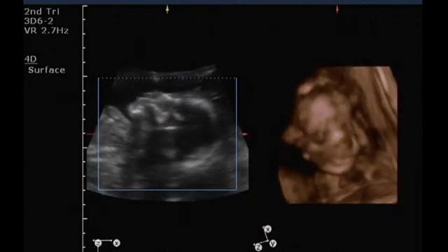 Алиса, 21 неделя 5 дней. попытки рассмотреть личико. смотреть онлайн