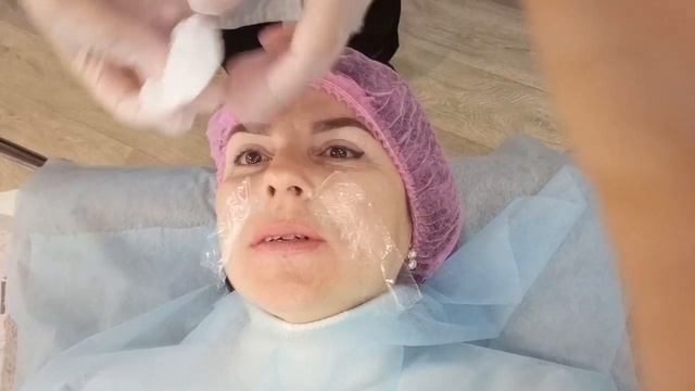 Есть ли жизнь после 50-ти!:))) Увеличиваю губы - пятый пункт моего плана!;) смотреть онлайн